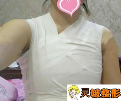 分享北京自体隆胸变美日记，从小女人成为大女人找回女性魅力