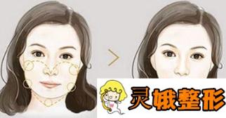 打注射瘦脸前后对比图分享，一个疗程就可以从大U脸变成小V脸啦