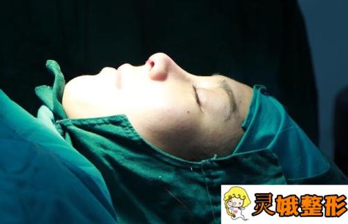 【案例分享】北京韩式耳软骨隆鼻果怎么样？变成天然美鼻不是梦