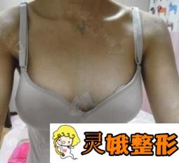 北京五洲女子医院整形价格表，附案例展示