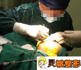 重庆西南医院整形科垫鼻子好吗？价格表及术后详情一览