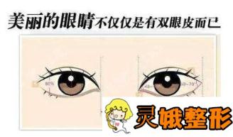 内眦赘皮能改良吗？上海玫瑰整形医院开眼角让你的眼睛更“闪”