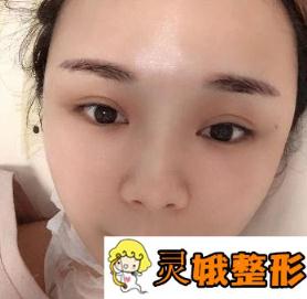 湘潭市中心医院整形美容科价格表2020版，附注射瘦脸整形日