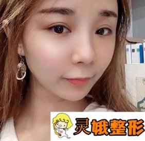 湘潭市中心医院整形美容科价格表2020版，附注射瘦脸整形日