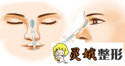 北京注射隆鼻术怎么样？果怎么样？能维持多久呢？