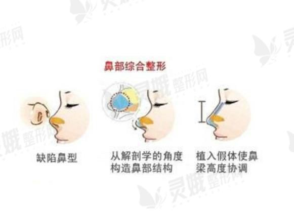 鼻部手术2.jpg