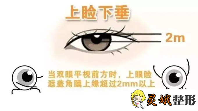 北京做双眼皮之双眼皮失败的修复方法,不同的问题有不同的修复方法