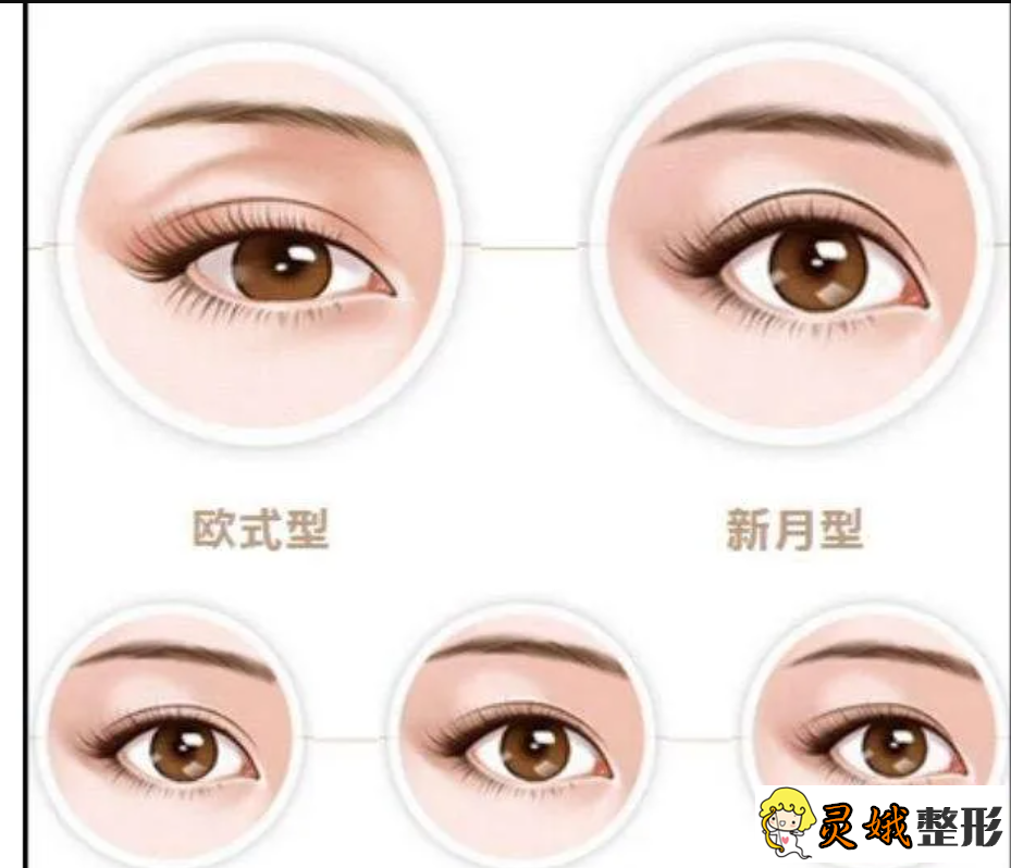 杭州割双眼皮医院排行榜，来看看你心仪的医美机构上榜了没？