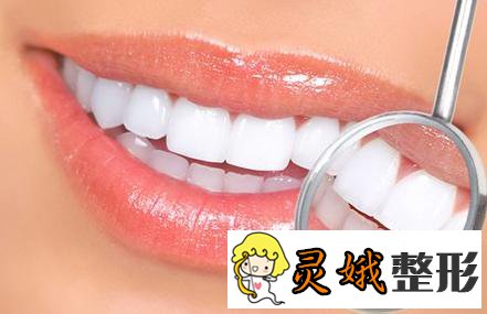 钴铬烤瓷牙的寿命以及术后注意事项，让牙齿更健康！