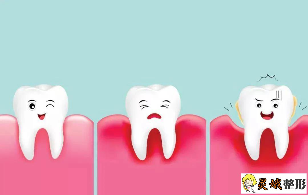 牙齿松动怎么治较好的办法？看完这些再也不用纠结了