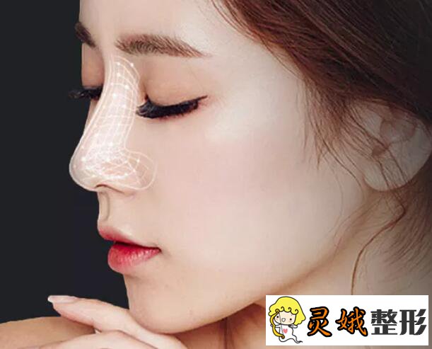 北京硅胶隆鼻手术价格多少钱？究竟是什么原因影响了手术的价格？