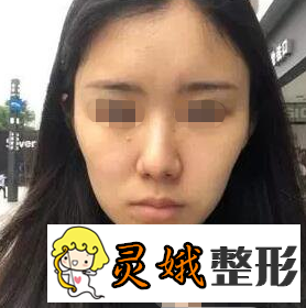 北京联合丽格整形医院正规吗？面部填充技术怎么样呢？