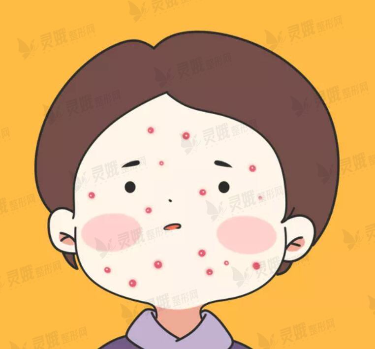 脸上长痘不同位置图解，脸上长痘也反应了内脏器官的健康状况？