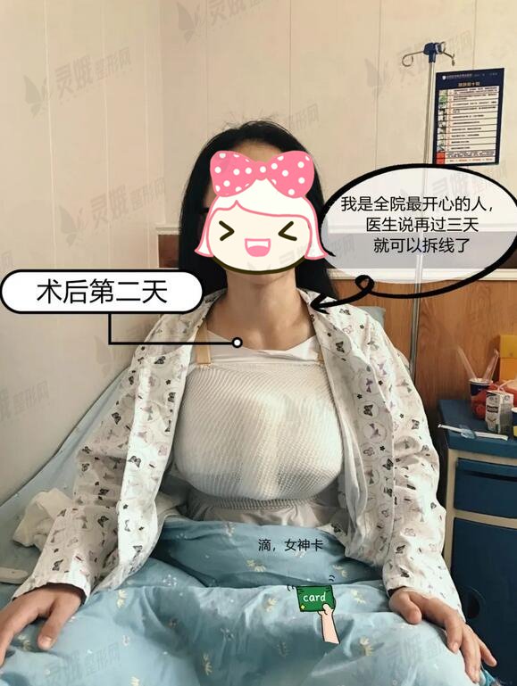 枣庄市立医院烧伤美容科隆胸案例