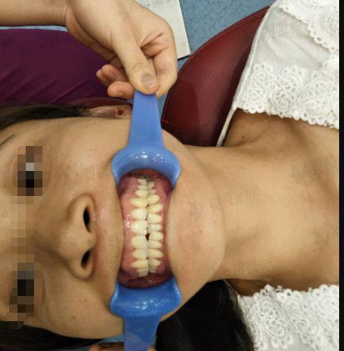 西安交大第一附属医院口腔科怎么样？费用表(牙齿矫正案例)信息一览