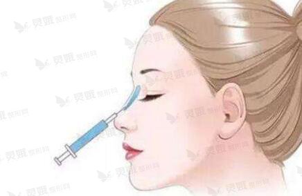 注射隆鼻有几种常见的方式？注射隆鼻的注意事项你要先搞清楚！