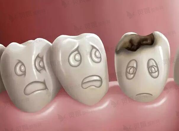 贵阳市第一人民医院口腔科综合怎么样？修复牙齿案例，告别“问题牙”