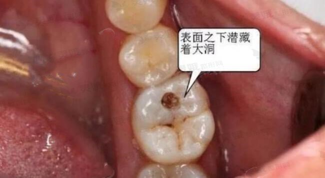 贵阳市第一人民医院口腔科牙齿修复中
