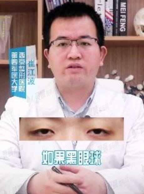 西京医院崔江波医生做双眼皮案例分享，近期收费情况曝光！