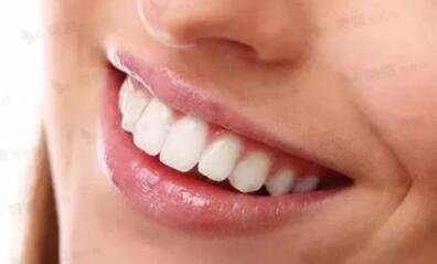 牙齿美白的果怎么长期保持