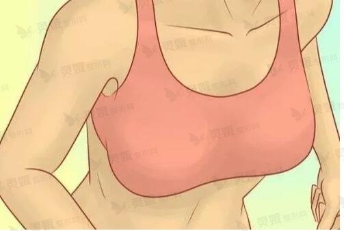 隆胸假体的尺寸选择需要注意什么