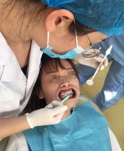 欢乐口腔医院牙齿矫正案例