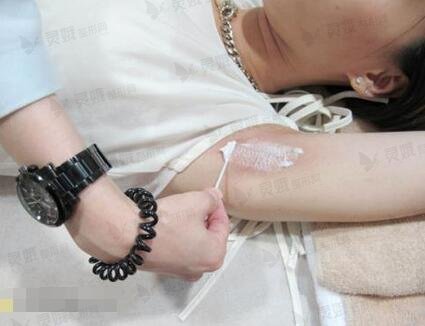 宁夏人民医院整形美容科做激光脱毛果图