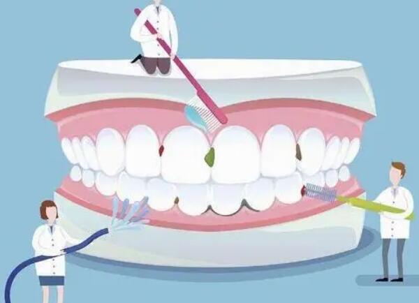 明星如何美白牙齿的？这3种方式你都知道哪些？美牙攻略~