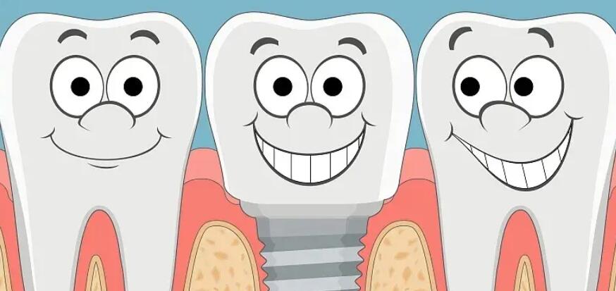 甘肃省人民医院口腔科种植牙果图(价格表)公开！附上真人手术过程|内幕揭晓！