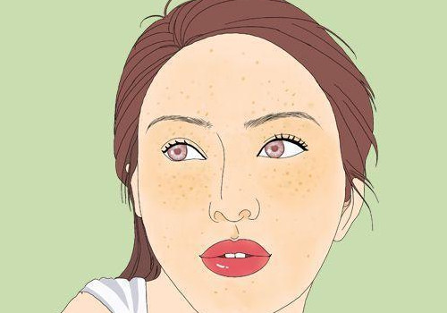 脸上长斑怎么样才能去除？睡眠和情绪会有影响吗？