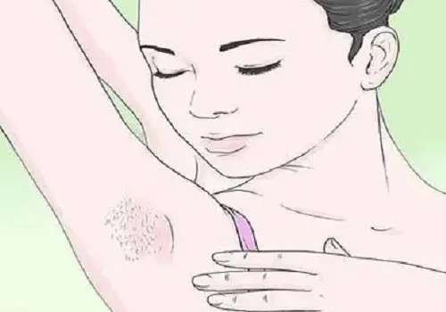 腋下有异味怎么办？使用止汗露或除臭剂可减轻！