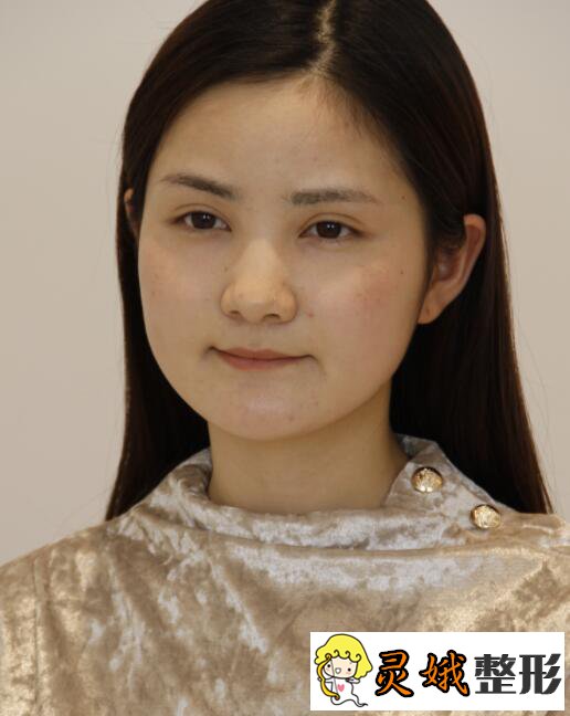 杭州市第三人民皮肤科许爱娥医生好不好医生简介