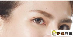 什么是韩式微创双眼皮？术后果好不好？