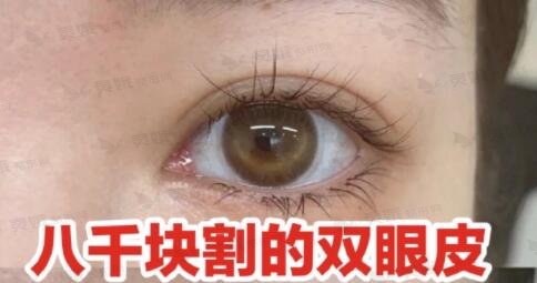 中国人欧式眼睛图片图片