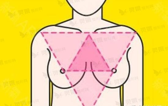 乳房提升棒棒糖手术的好处