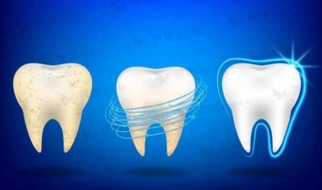 牙齿矫正的方案是什么