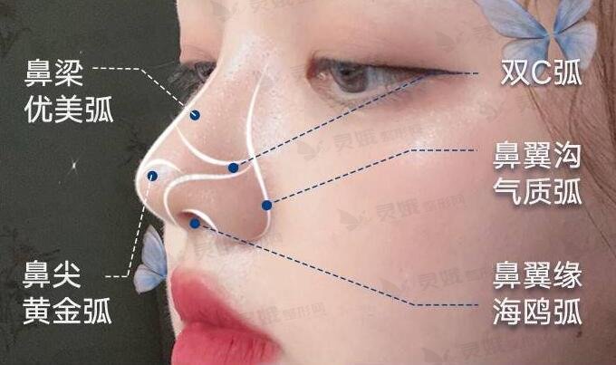 鼻部手术整形手术需要多长时间恢复期