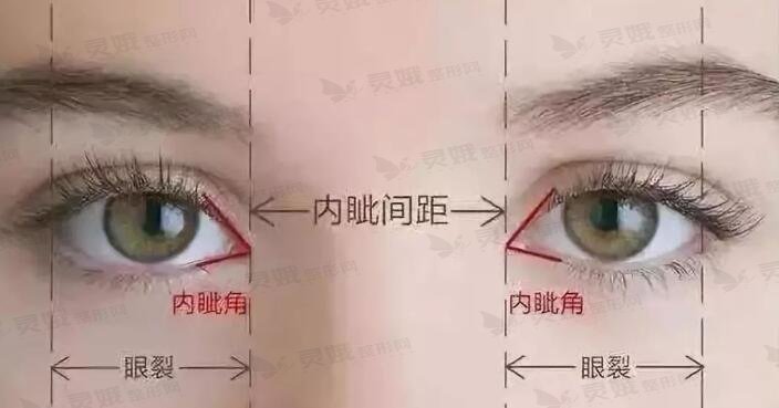 中国解放军总医院整形修复科韩岩医生双眼皮手术