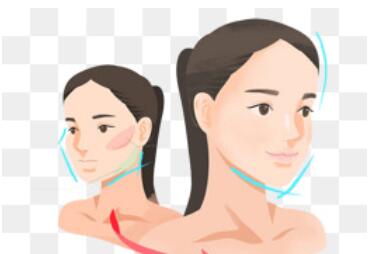 女人过大下颌角整形怎么样？适合哪些人做？来看详细介绍