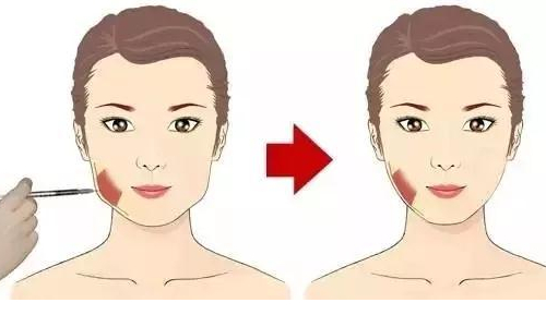 注射瘦脸的危害有哪些？有哪些作用？